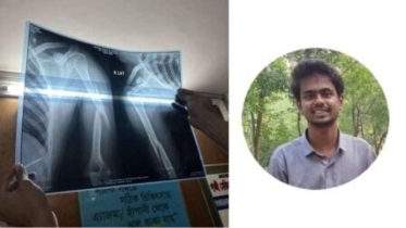 ছাত্রদলের হামলায় কুয়েট শিক্ষার্থীর ‘হাড় তিন টুকরা’