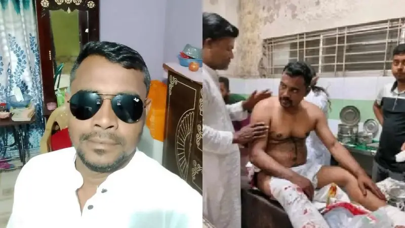 বাগেরহাটে যুবদল নেতার দুই পায়ের রগ কেটে দিয়েছে প্রতিপক্ষরা